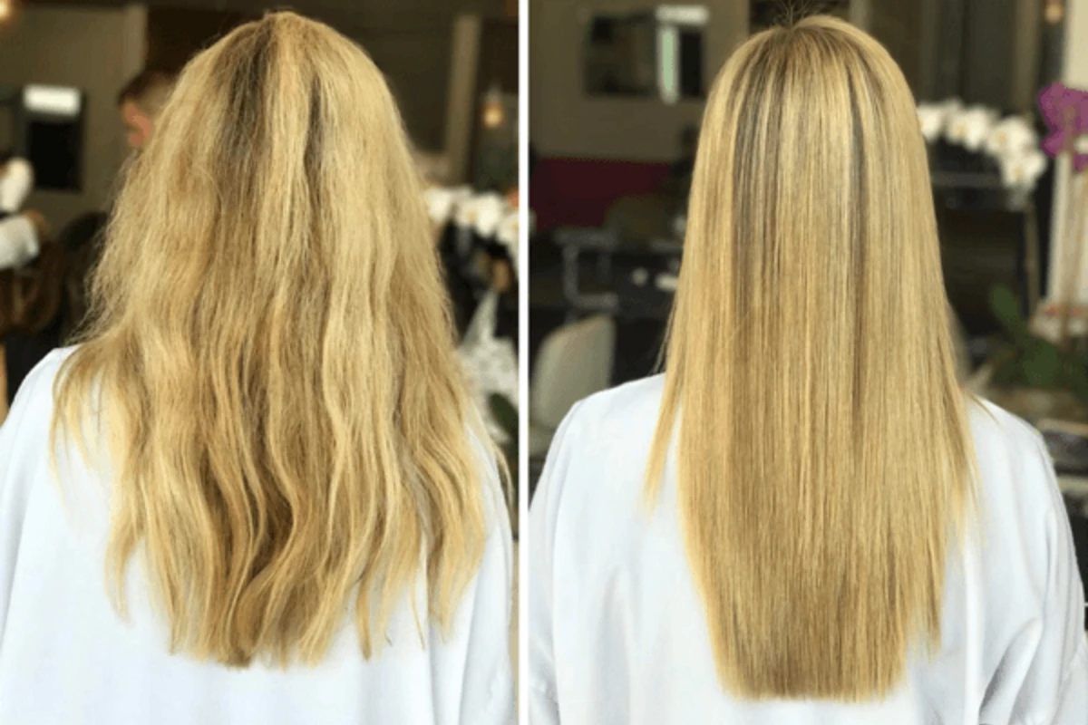Keratinin qorxunc fəsadından danışan dermotoloq: Demək olar ki, zəhərdir - VİDEO
