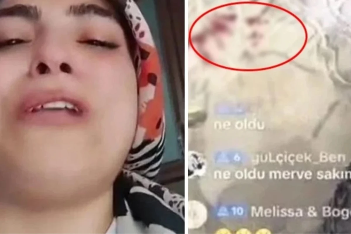 Övladı qan içində canlı yayım açan Tik-Tok istifadəçisi saxlanılıb - VİDEO