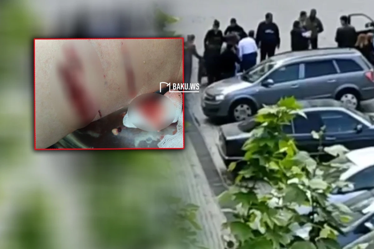 Sahibsiz itlər Xırdalanda sakinə hücum etdilər - FOTO/VİDEO