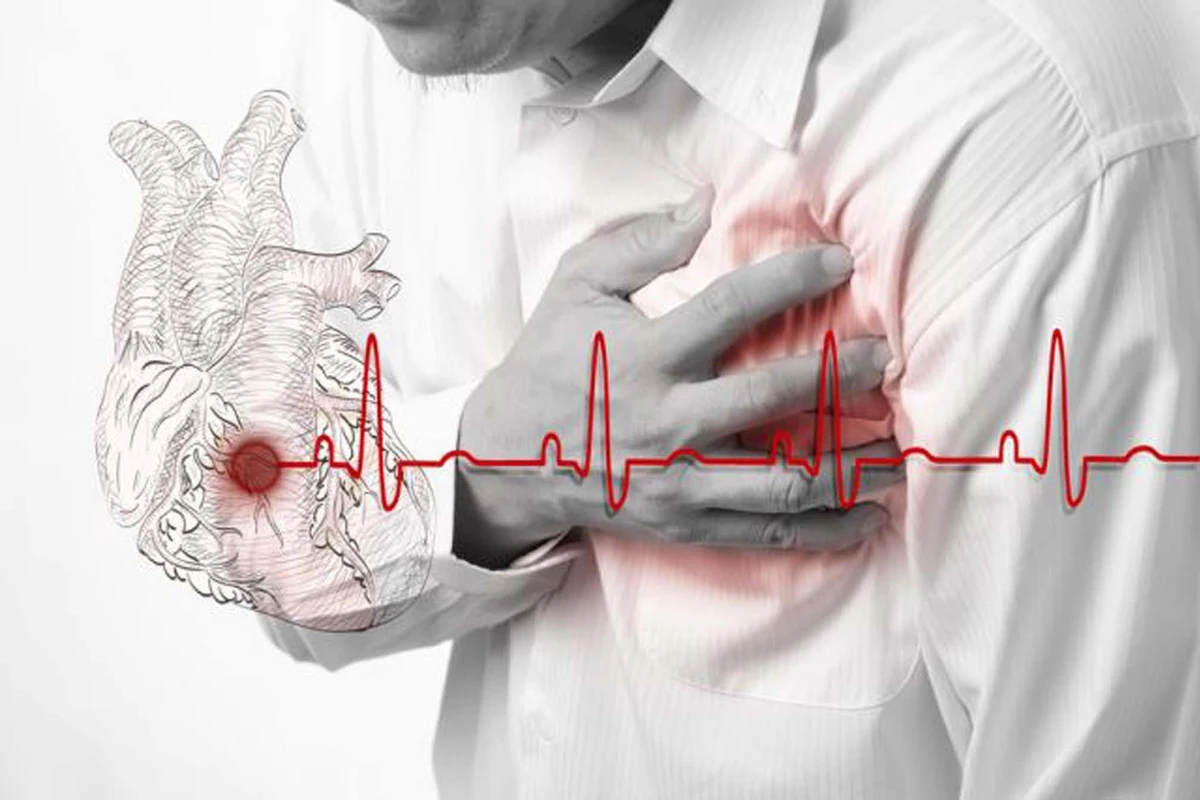 Yay aylarında infarkt və insult riskini necə azaltmaq olar?  - Həkim açıqladı