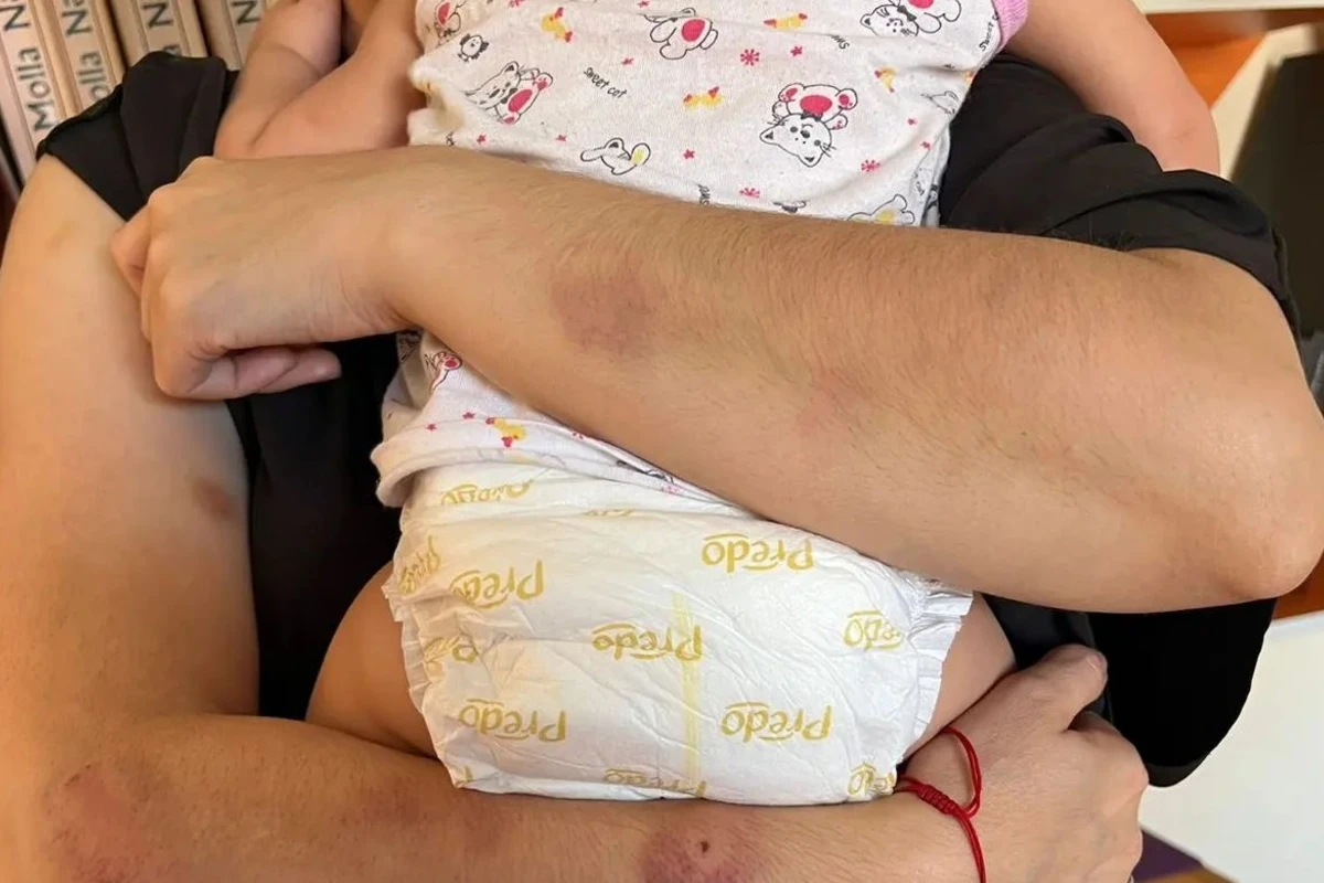 Azərbaycanda müəllim əri tərəfindən zorakılığa məruz qalıb - YENİLƏNİB