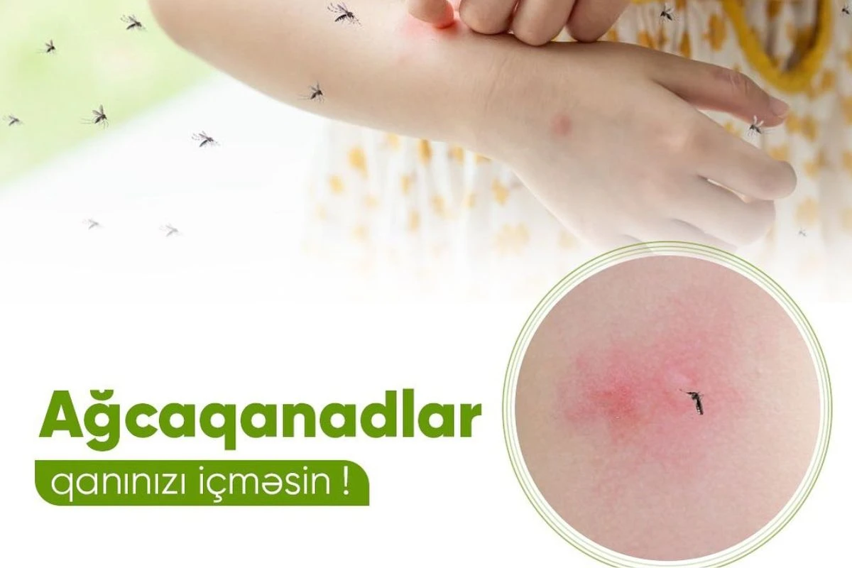 Ağcaqanadlar niyə artıb? - FOTO