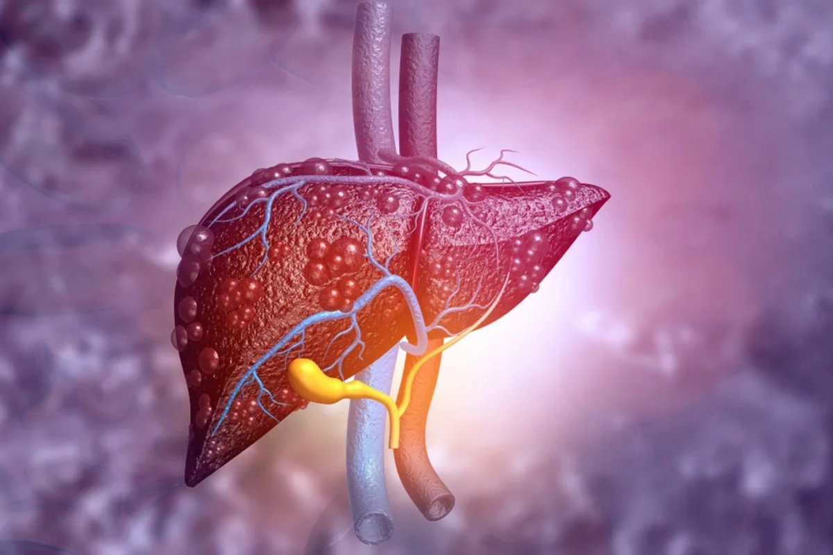 Named non-obvious signs of liver problems