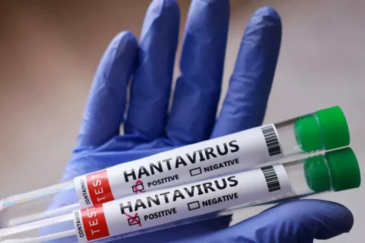 Venesuelada hantavirus diaqnozu təsdiqlənmiş üç pasiyent ölüb