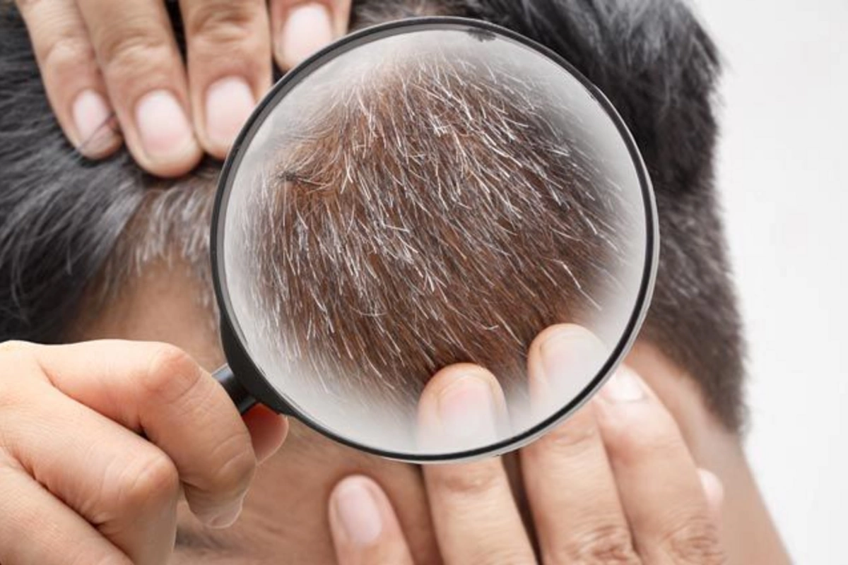 Why Gray Hair Appears Early: Shocking Facts You Should Know Why Gray Hair Appears Early: Shocking Facts You Should Know