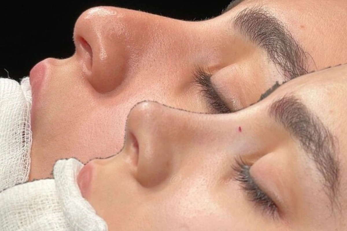 What awaits plastic surgeons who are not included in the ministry's list?