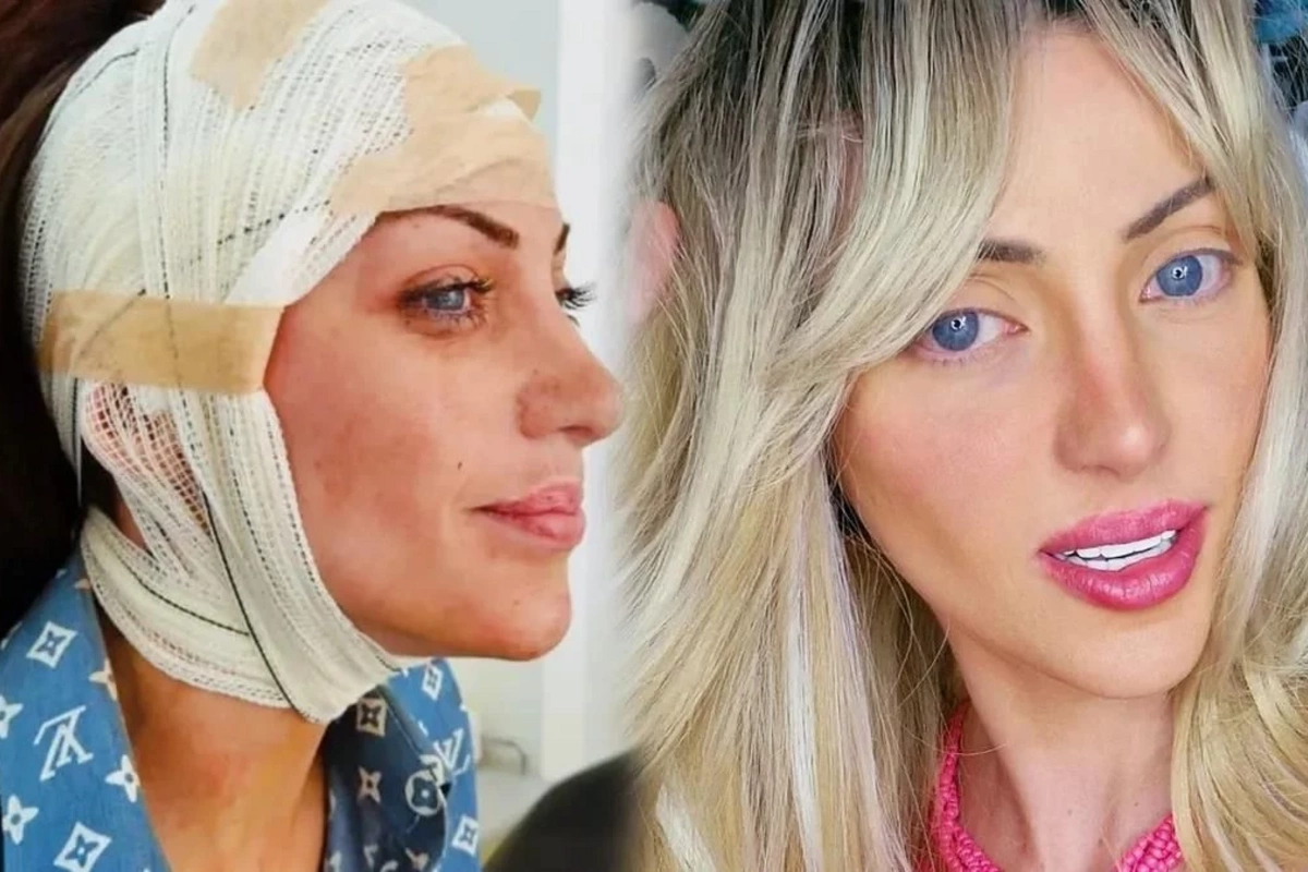 Canlı Barbie kimi tanınan influser müəmmalı şəkildə ölü tapılıb