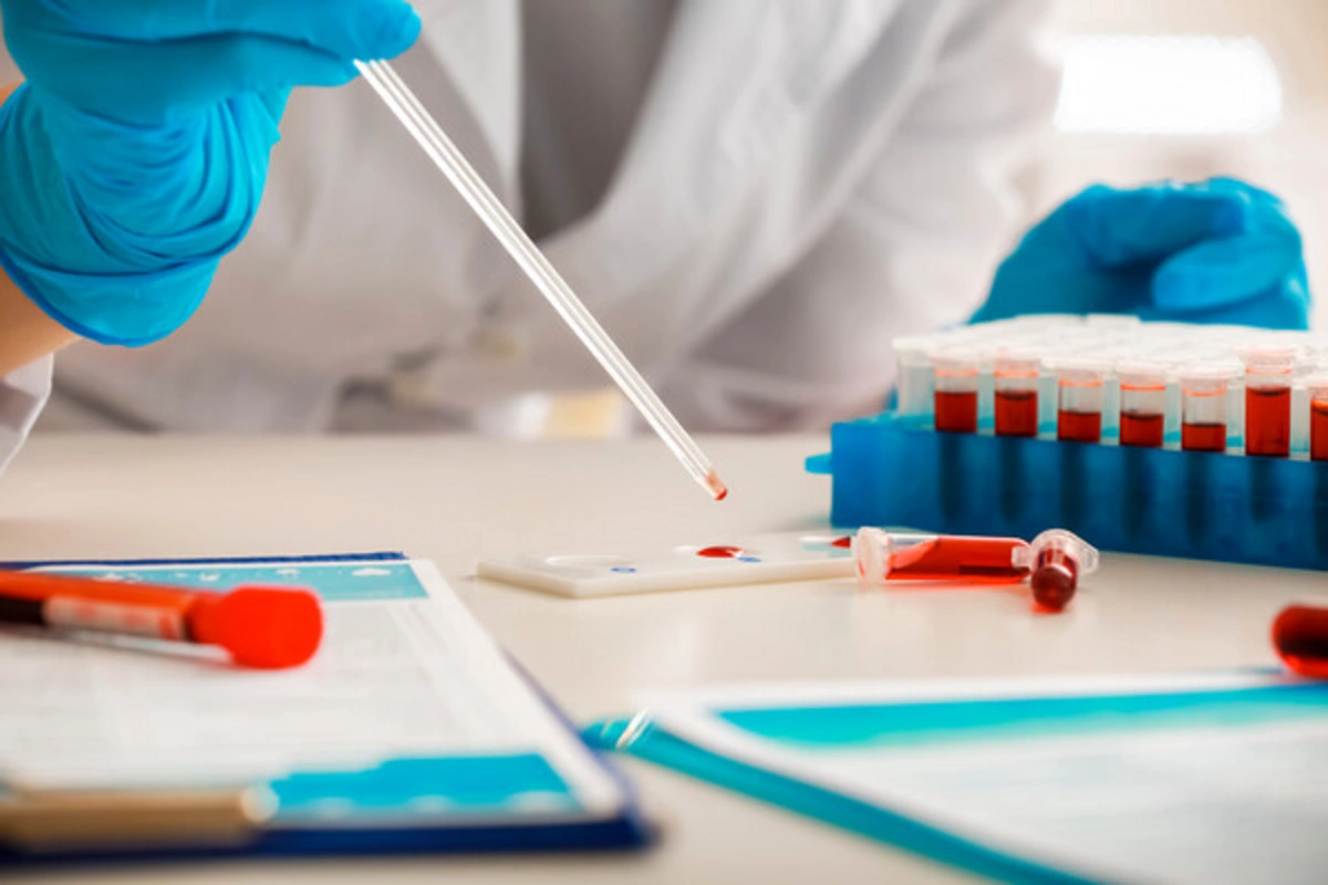 A factor that accelerates aging in middle-aged men has been identified