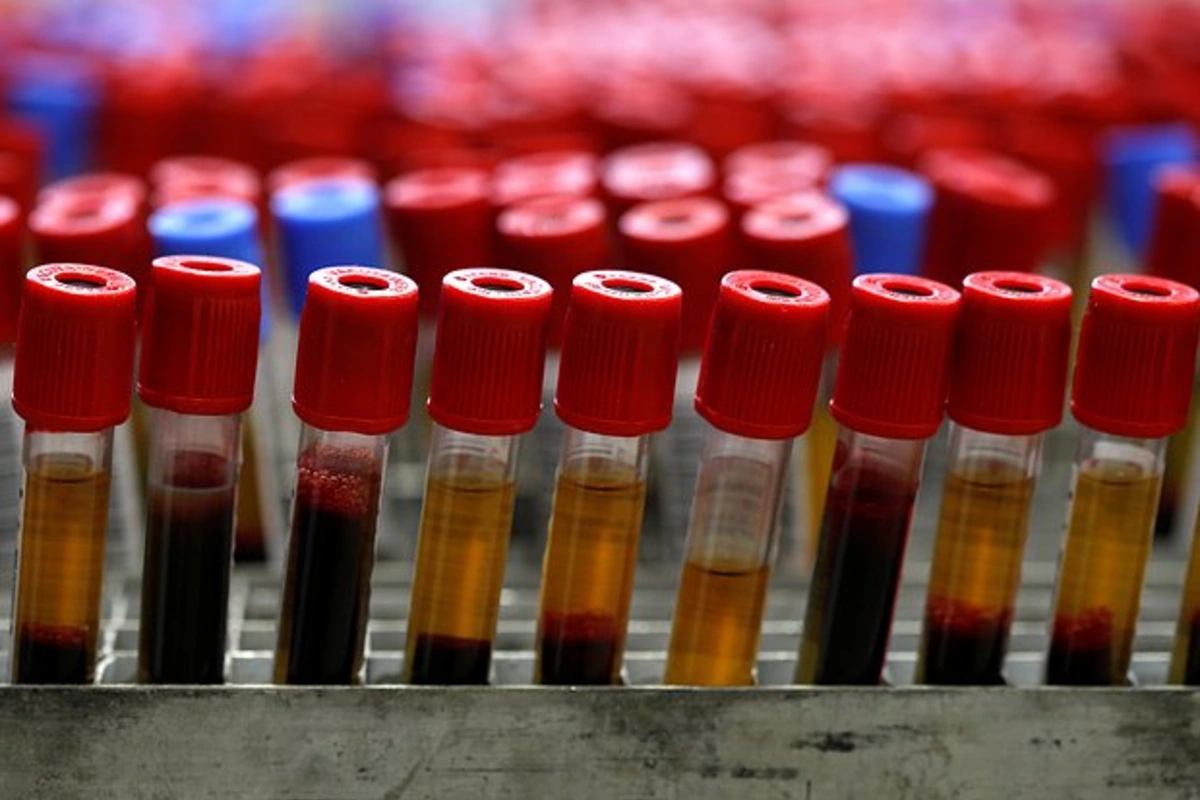 Найден способ точно предсказать риск ранней смерти