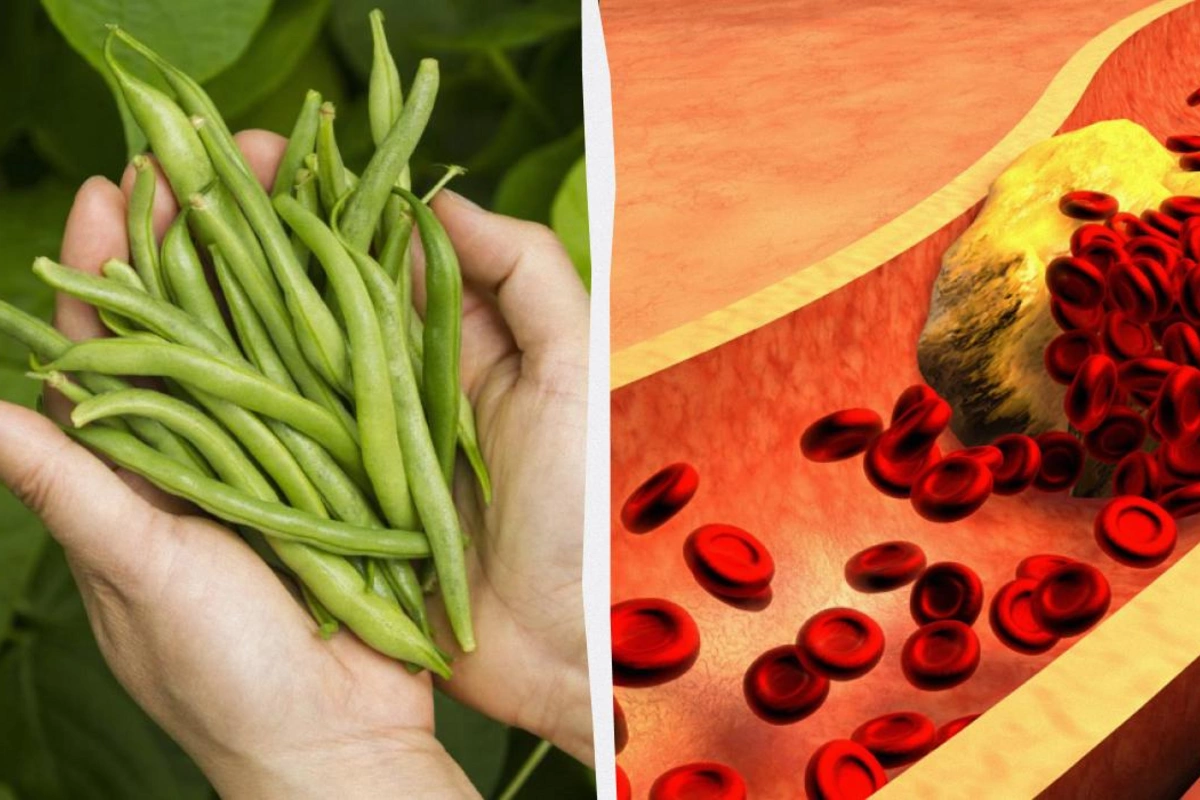 Диетолог назвала лучший углевод, который снизит уровень холестерина в крови Диетолог назвала лучший углевод, который снизит уровень холестерина в крови