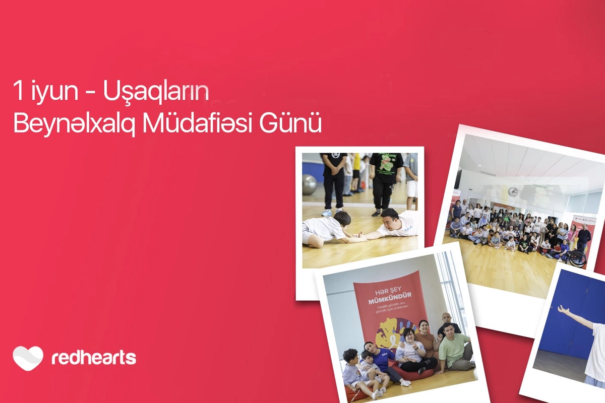 Hər şey mümkündür: Daun sindromlu uşaqlar üçün sosial layihə