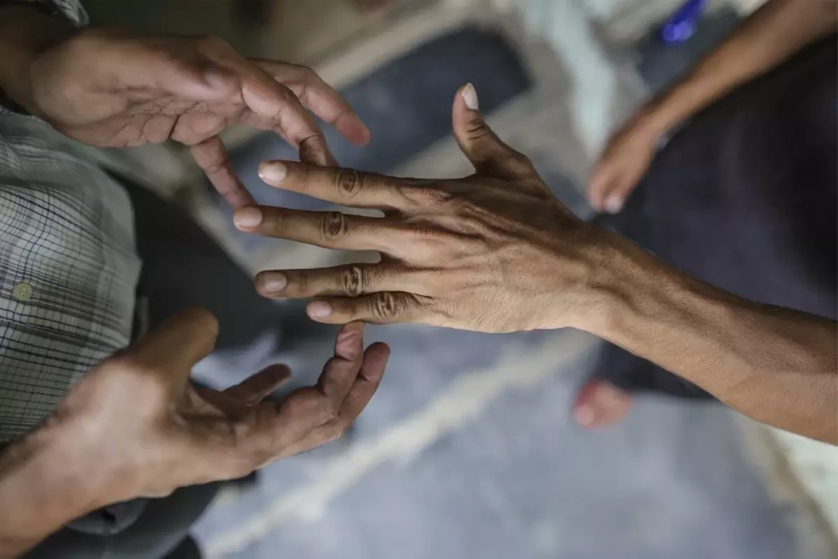 Rumıniyada 44 il sonra ilk dəfə cüzam xəstəsi aşkarlandı