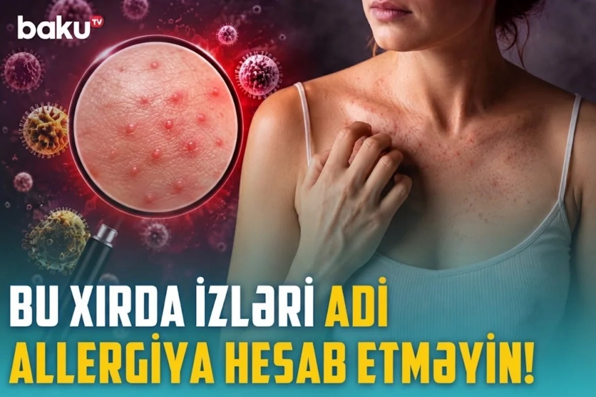 Qısa təmasla yoluxma riski: Ev heyvanınız infeksiya mənbəyinə çevrilə bilər