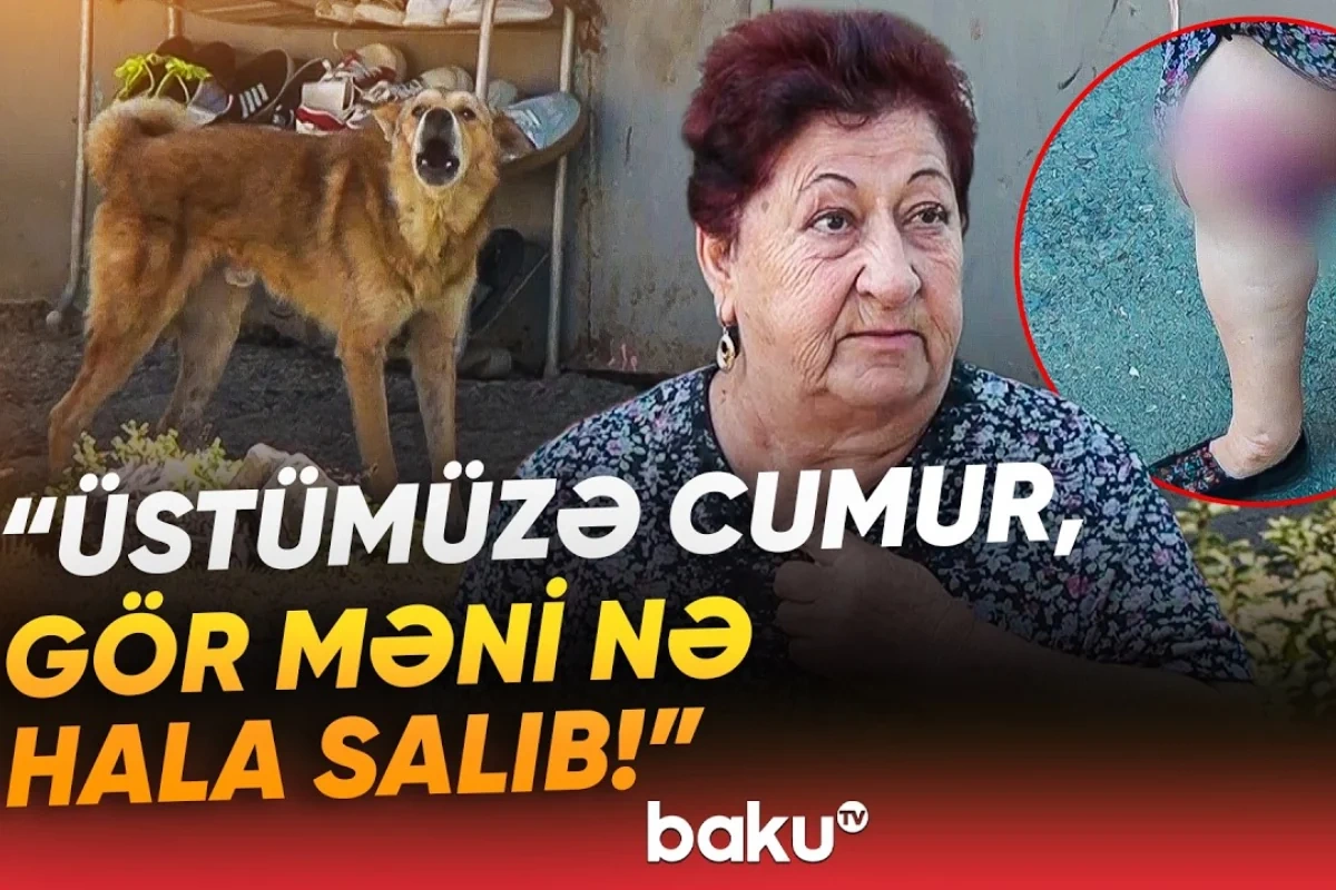 Əhali dəhşət içində: Sahibsiz itlər 75 yaşlı qadını dişləyib