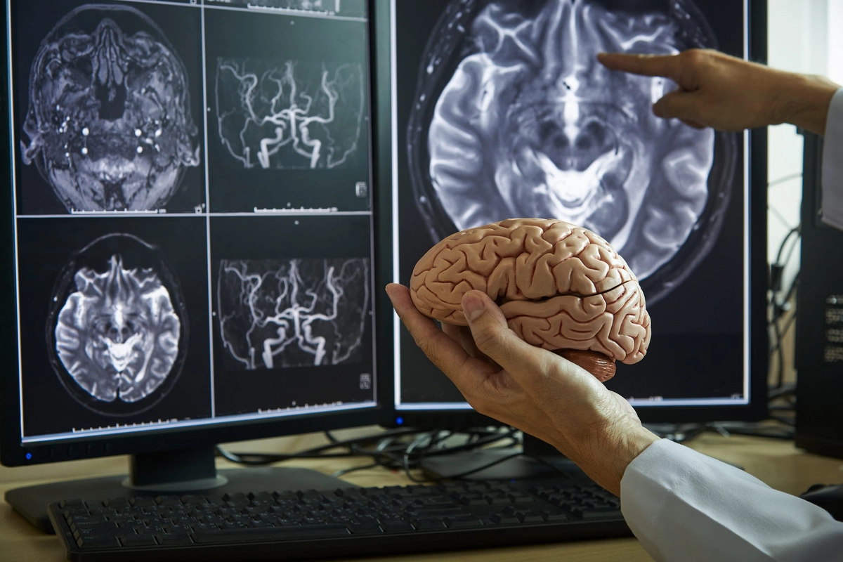 A way to detect brain tumors without MRI and tests has been found A way to detect brain tumors without MRI and tests has been found