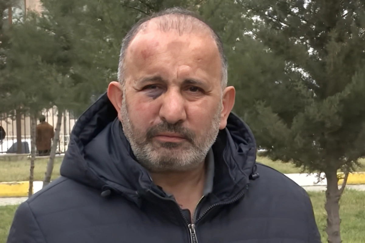 Ata və oğlu tərəfindən döyülən Azəriqaz əməkdaşı: Deyirdi vur ölsün