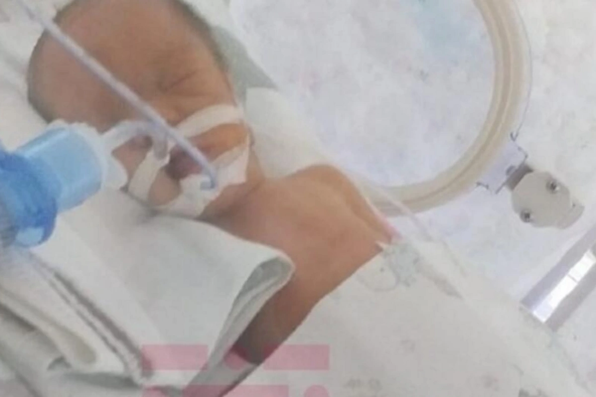 В Баку двое из тройняшек погибли после рождения, родители обвиняют врачей В Баку двое из тройняшек погибли после рождения, родители обвиняют врачей
