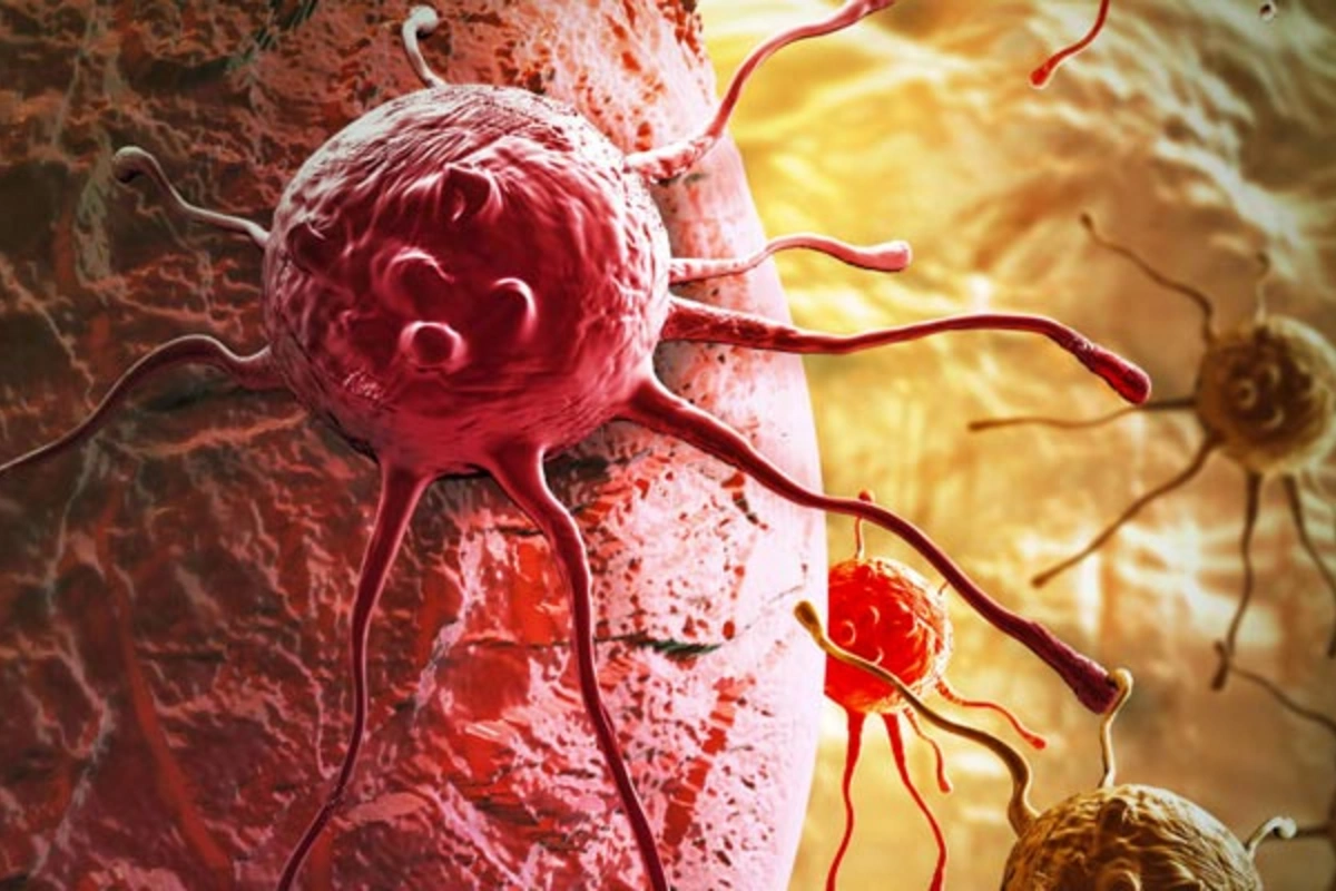 Nazir: Onkoloji xəstəliklər regionda ölüm hallarının əsas səbəblərindən biridir