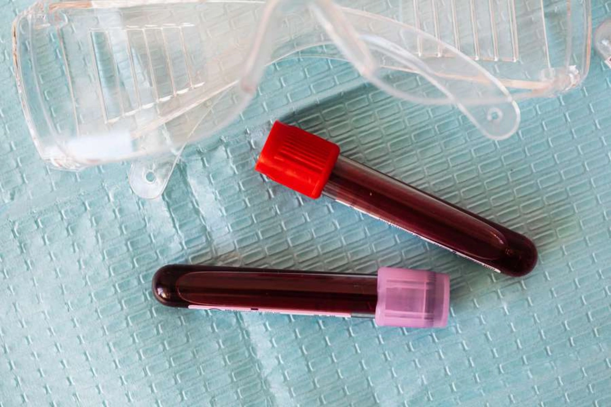 Blood test that helps predict heart attack Blood test that helps predict heart attack