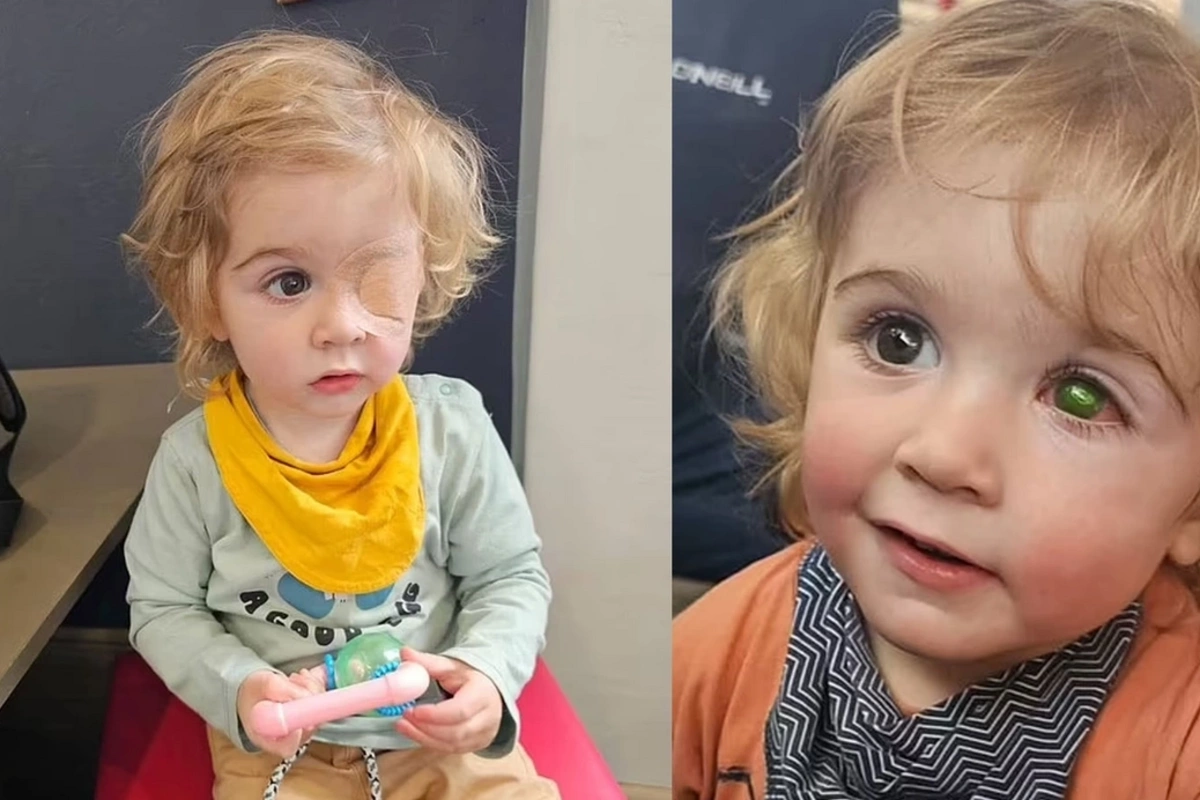 Two-year-old child lost vision after a relative's kiss