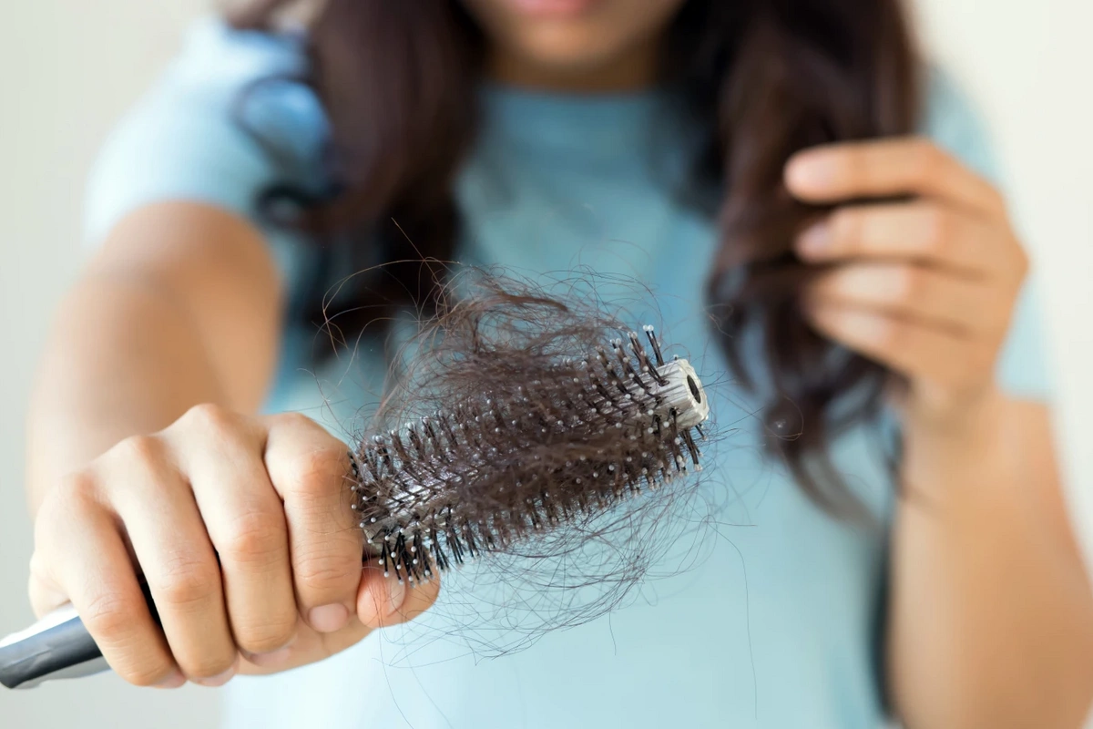 Врач назвала неочевидные причины выпадения волос