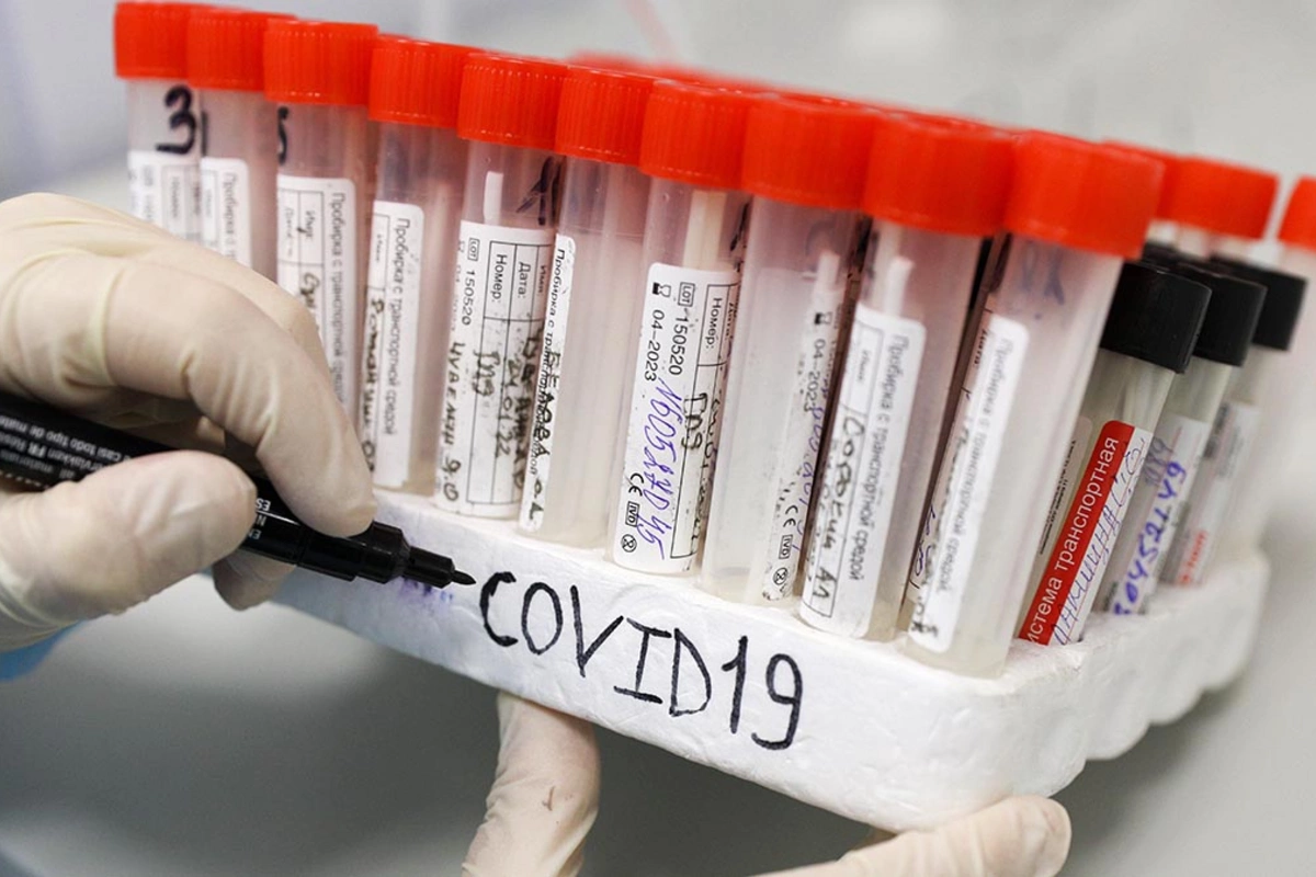 Named the signature symptom of the new coronavirus strain Named the signature symptom of the new coronavirus strain