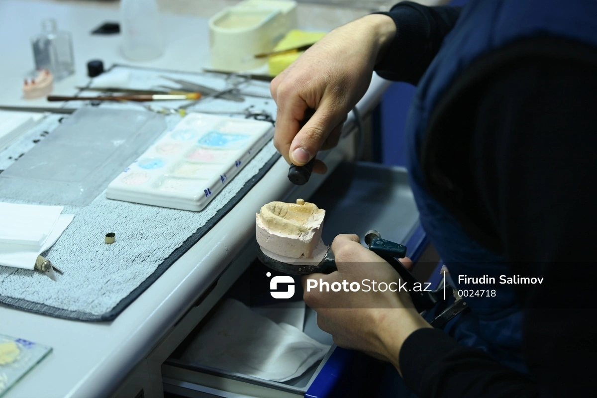 TƏBİB: Bəzi tibb müəssisələrində stomatoloqa il ərzində bir nəfər belə müraciət etmir