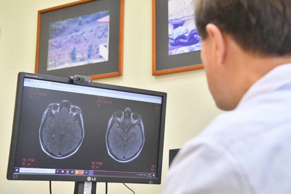 Названа скрытая причина редкого детского инсульта