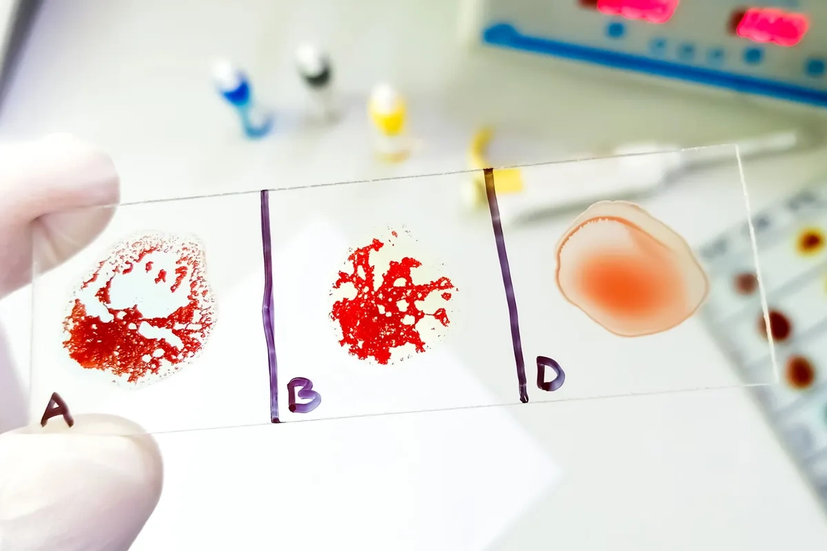 Hansı qan qrupu sağlamlıq baxımından daha üstün sayılır? – Araşdırma