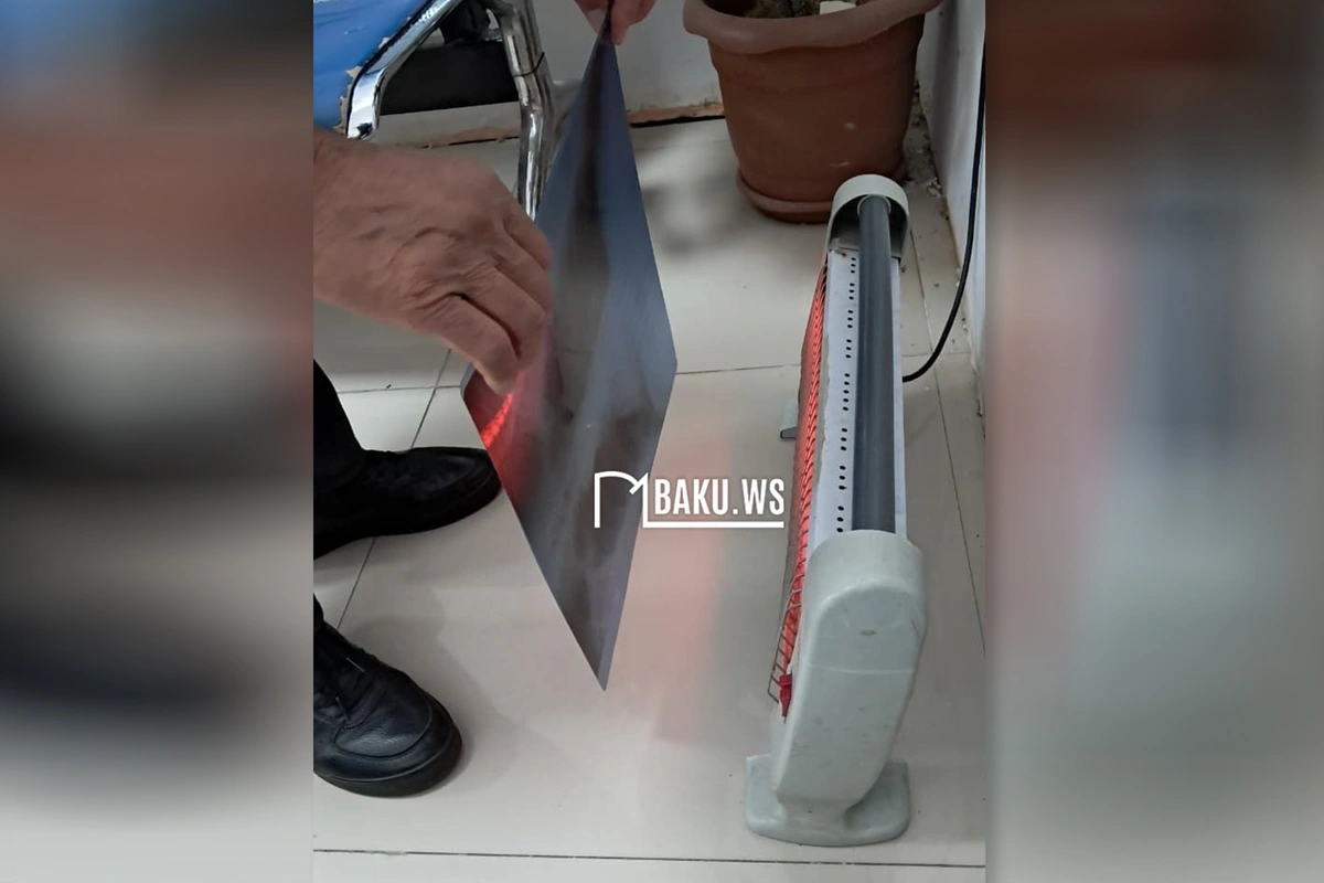 38 saylı poliklinikada rentgen kağızı elektrik plitəsi ilə quruduldu