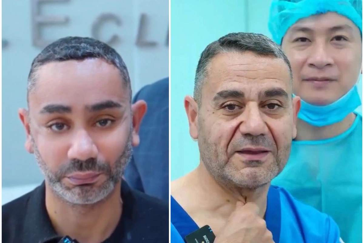 58 yaşlı kişi gəncləşmək üçün Vyetnama getdi, tanınmaz hala düşdü
