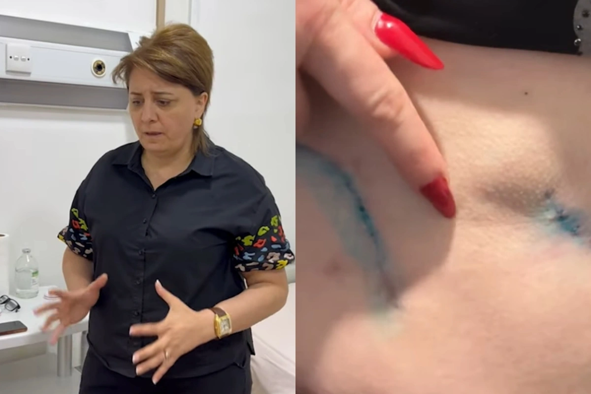 Prokurorluqda pasiyentin ölüm işində adı keçən həkim yenidən cərrahlıq edir? Prokurorluqda pasiyentin ölüm işində adı keçən həkim yenidən cərrahlıq edir?