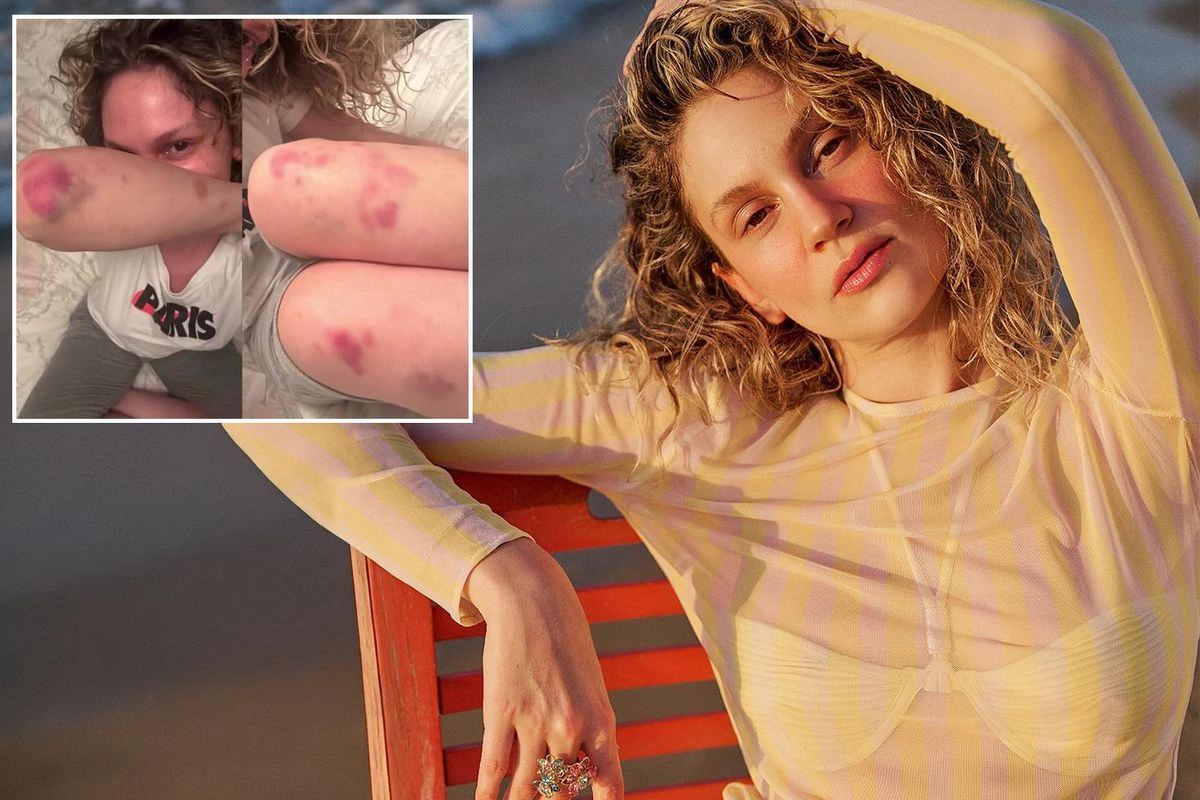 Farah Zeynep Abdullahın bu görüntüləri sevənlərini qorxutdu