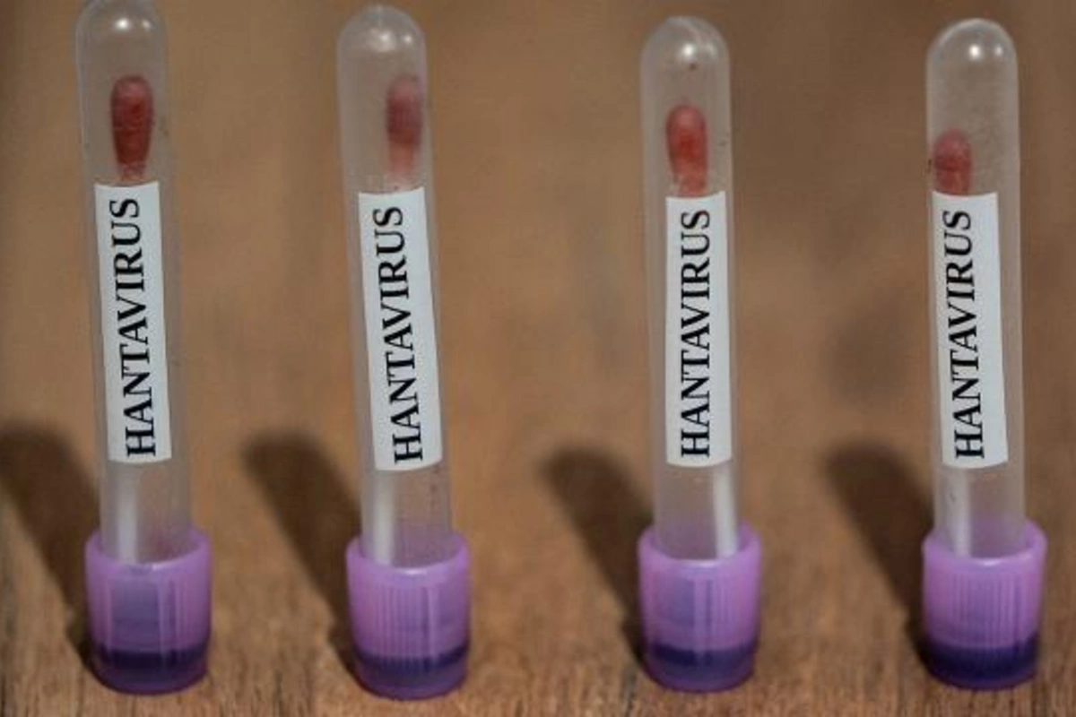 ABŞ hantavirus hallarını 3-cü səviyyə fövqəladə vəziyyət kimi izləməyə başladı