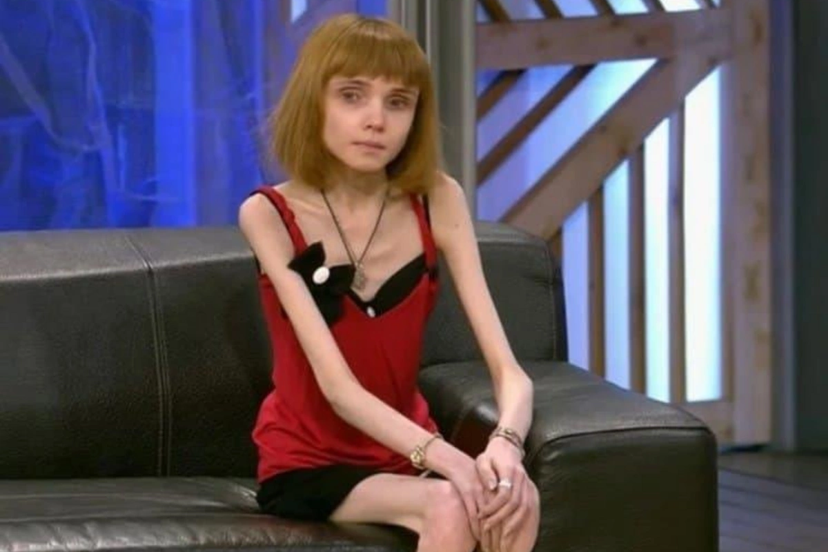 17 Kiloqram çəkisi olan fenomen qadın: Hər kiloqram qələbədir