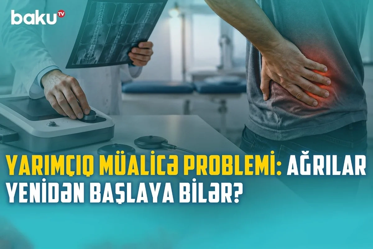 Fizioterapiyanın əks-göstərişləri hansılardır?