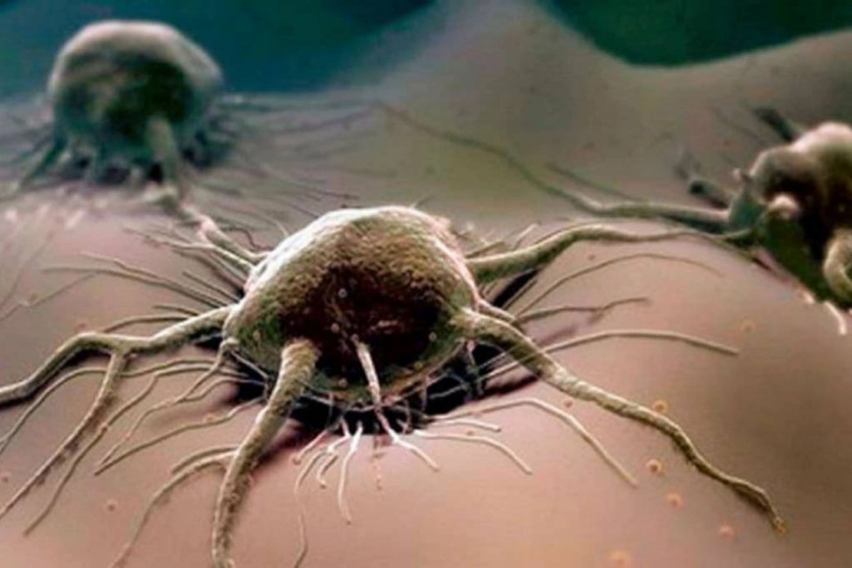 Cancer mortality has sharply increased due to an unexpected factor
