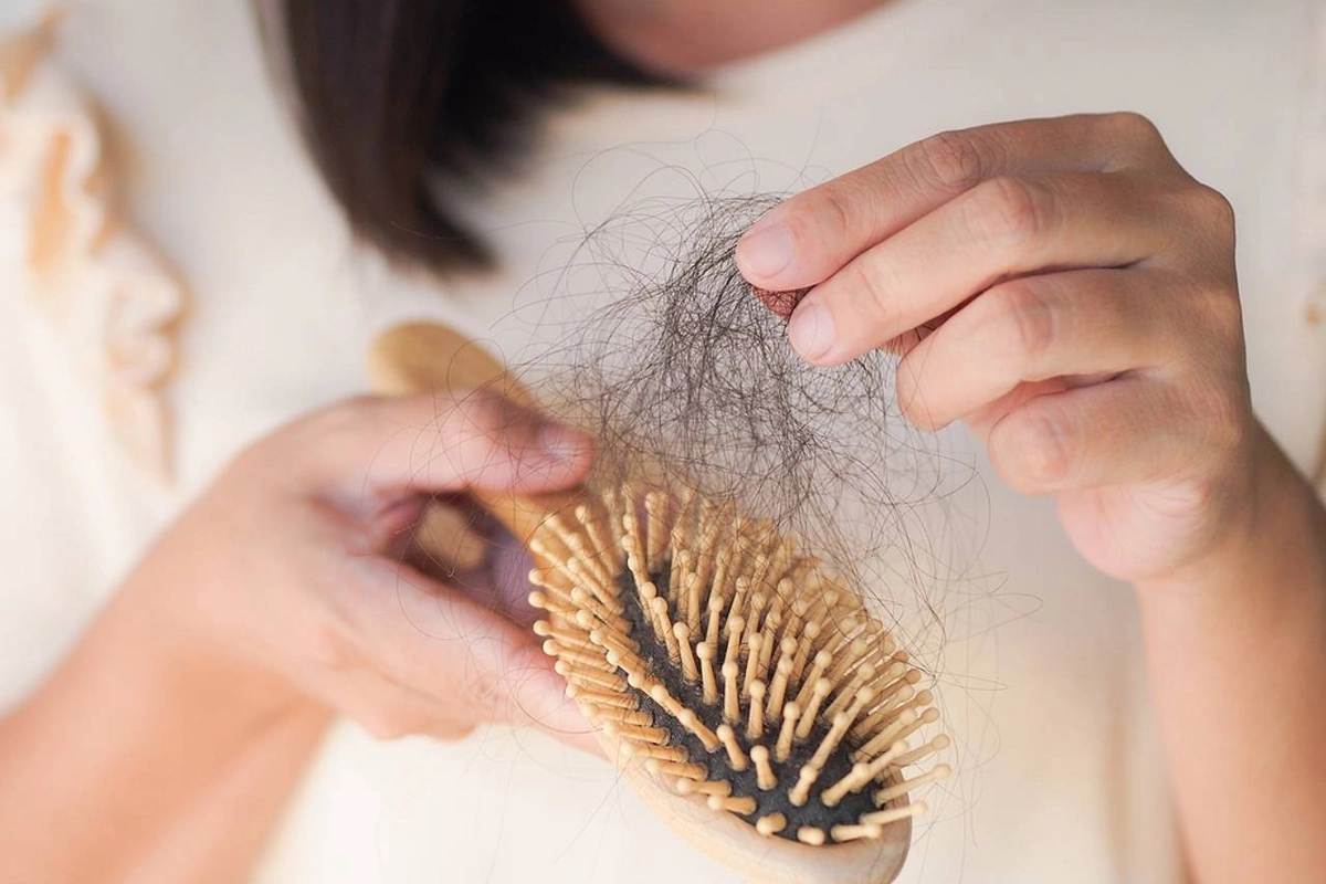 Doctor named non-obvious causes of hair loss