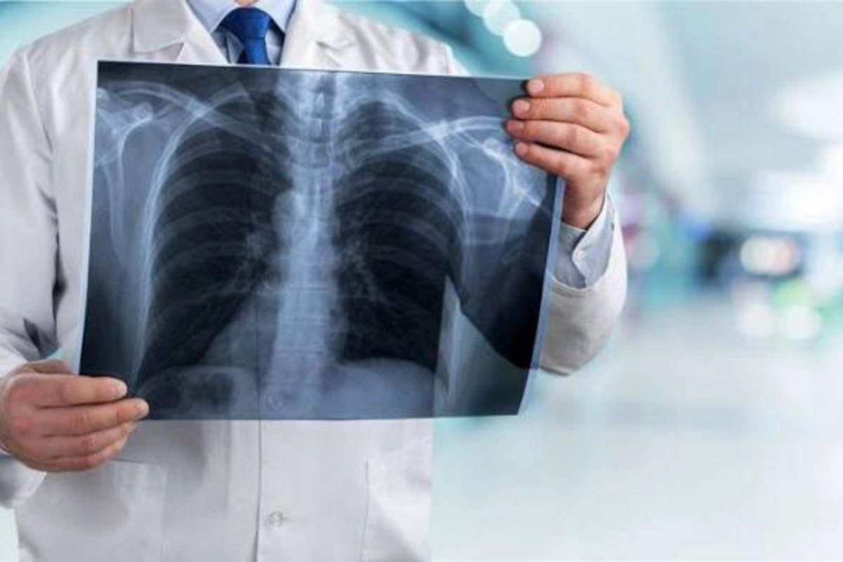 Doctor warned about the insidiousness of lung diseases