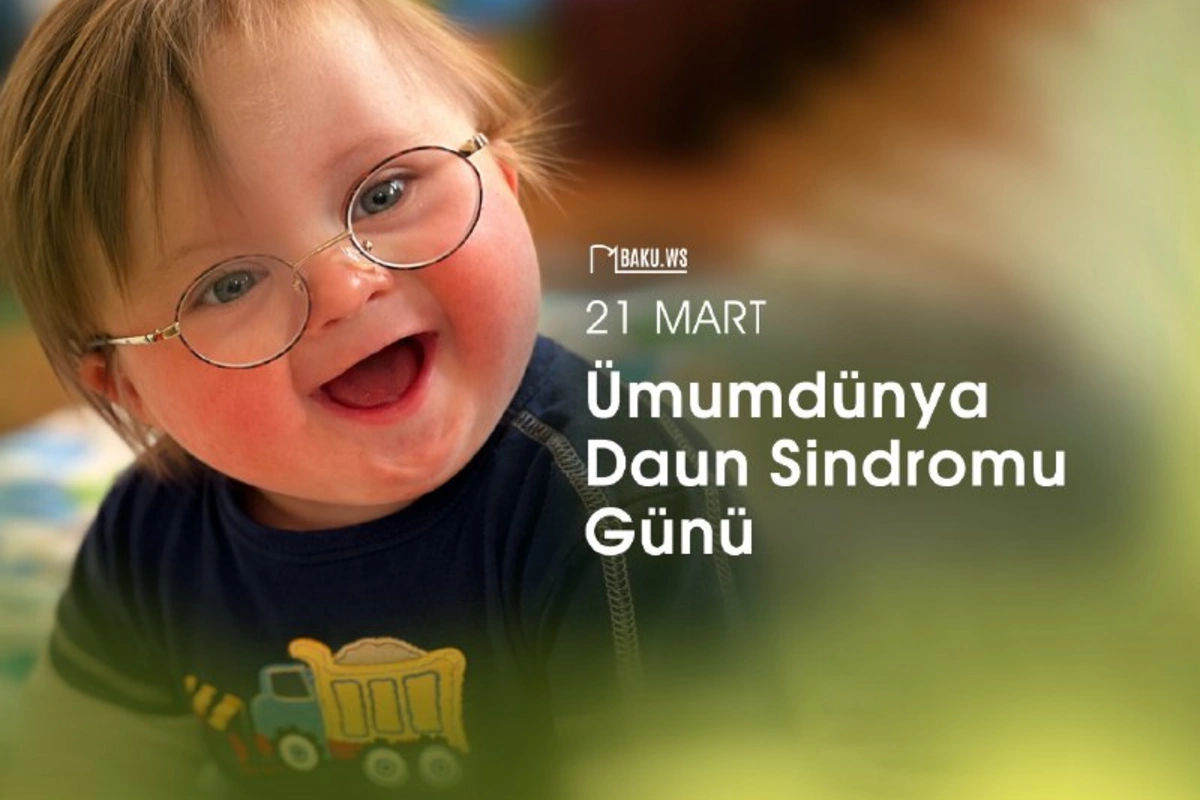Bu gün Ümumdünya Daun Sindromu Günüdür