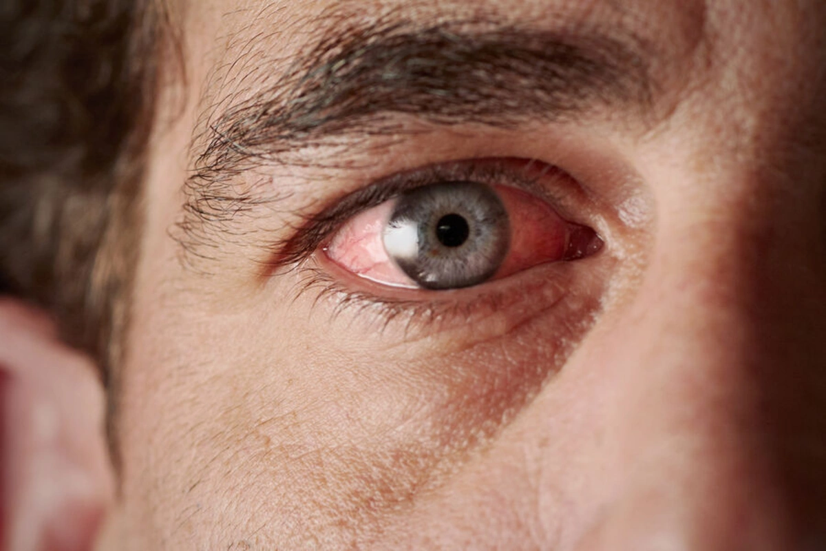 How to recognize health problems by looking at the eyes?