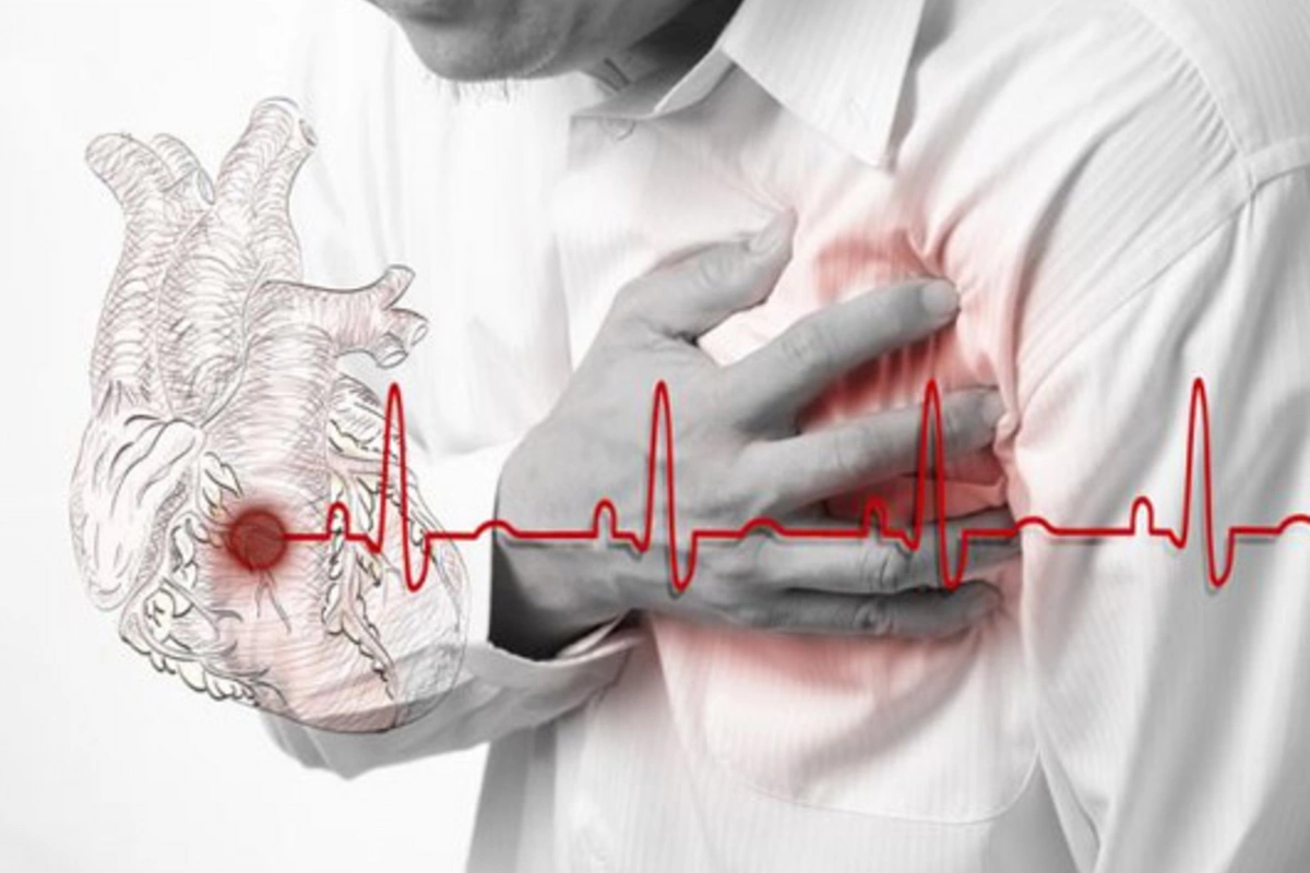 Alimlər infarkt və insultun qarşısını almağın yeni yolunu KƏŞF ETDİ - Bu dərmanla…