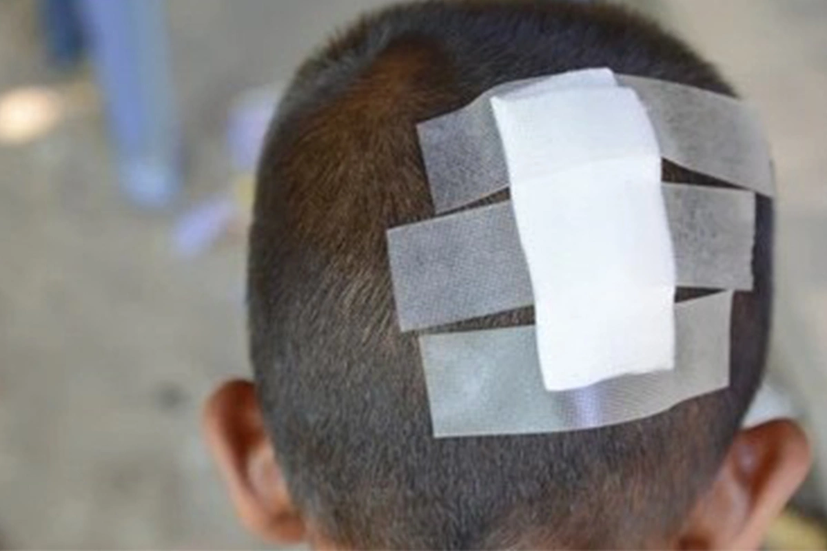 Hesaba görə kafe sahibi ilə mübahisədə - 6 yaşlı oğlu başından zərbə aldı