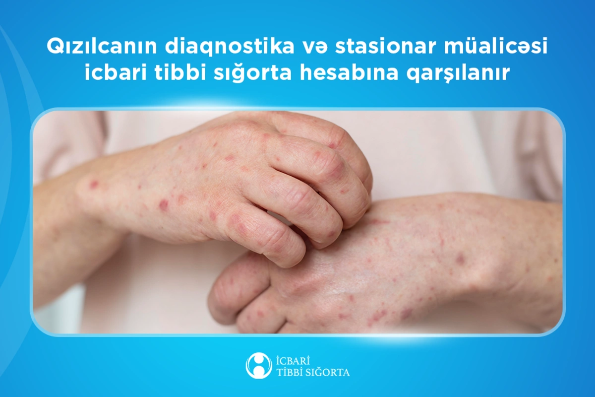Bu XƏSTƏLİYİN diaqnostika və stasionar müalicəsi icbari tibbi SIĞORTA hesabına qarşılanır Bu XƏSTƏLİYİN diaqnostika və stasionar müalicəsi icbari tibbi SIĞORTA hesabına qarşılanır