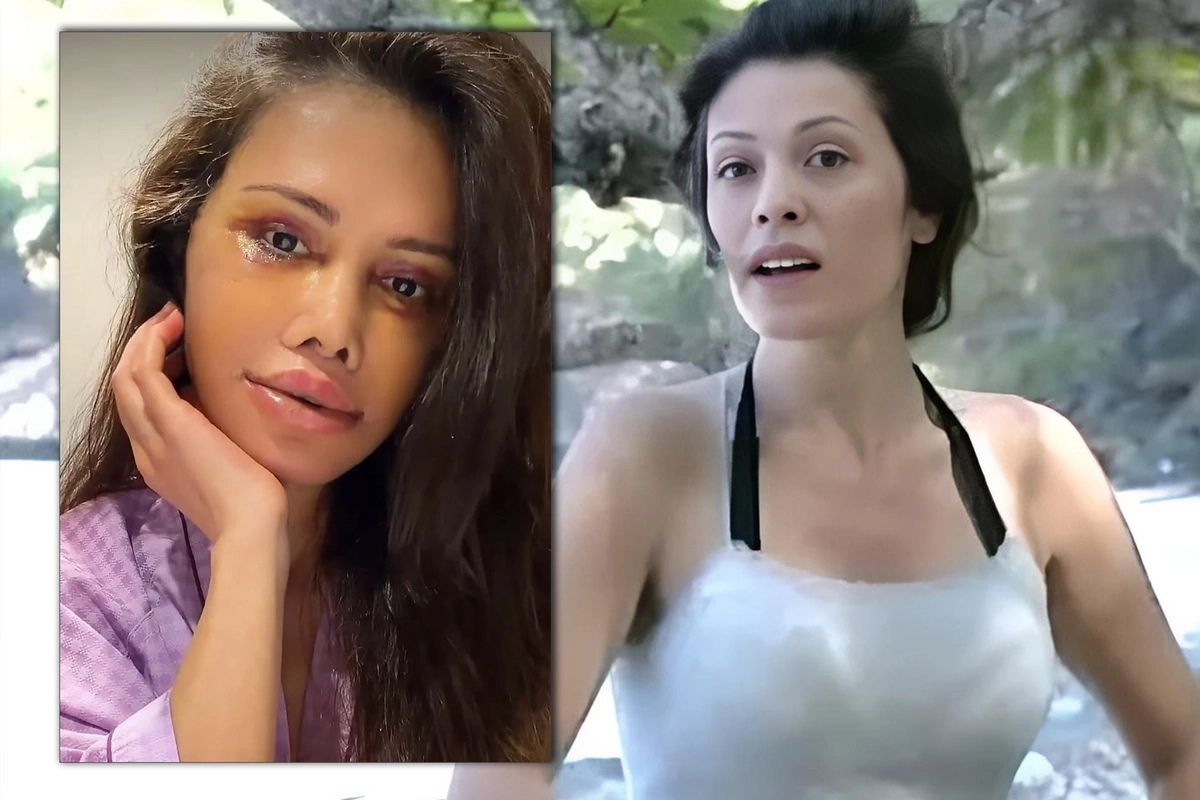 Keçmiş Survivor iştirakçısı üz nəqli əməliyyatı keçirdi