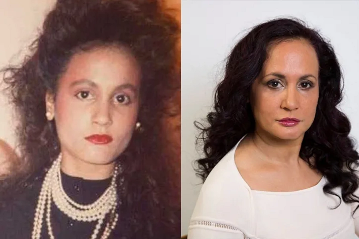 Üz dərisi qırışmasın deyə 49 ildir gülmür