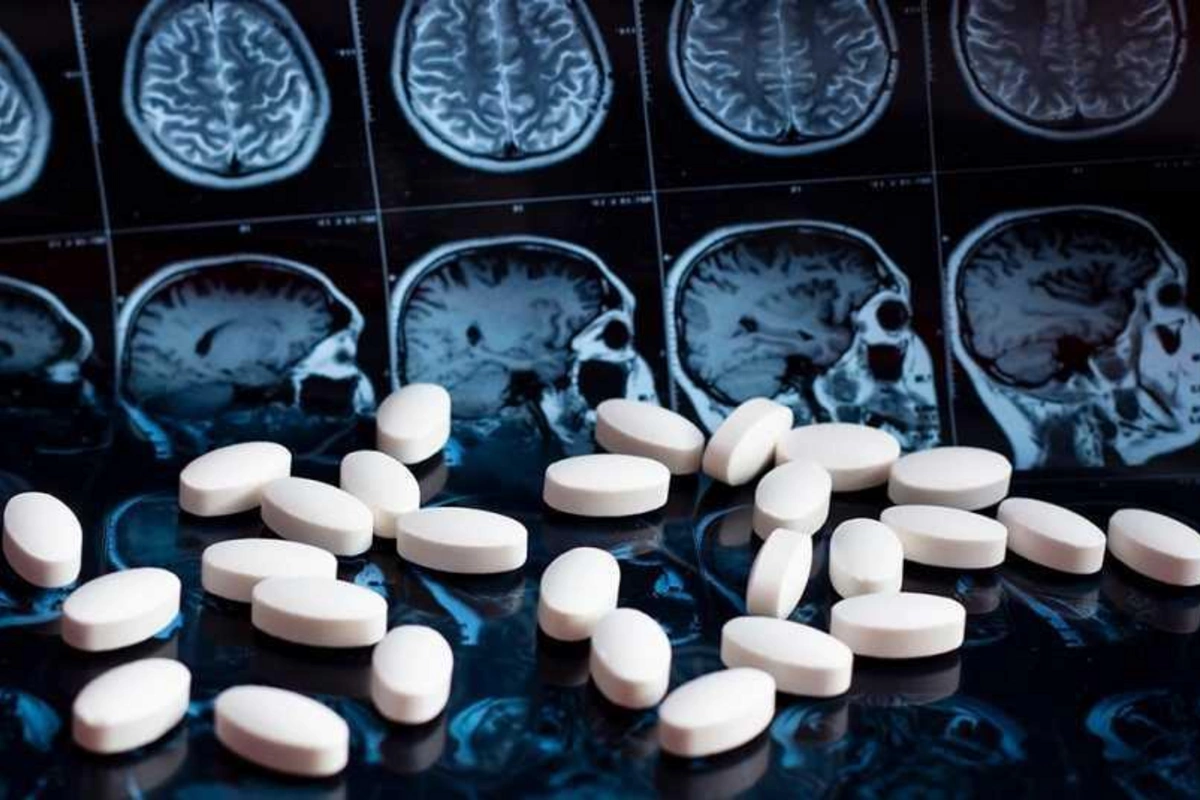 Sağlamlıq göstəriciləri alzheimer xəstəliyi ilə necə bağlıdır?