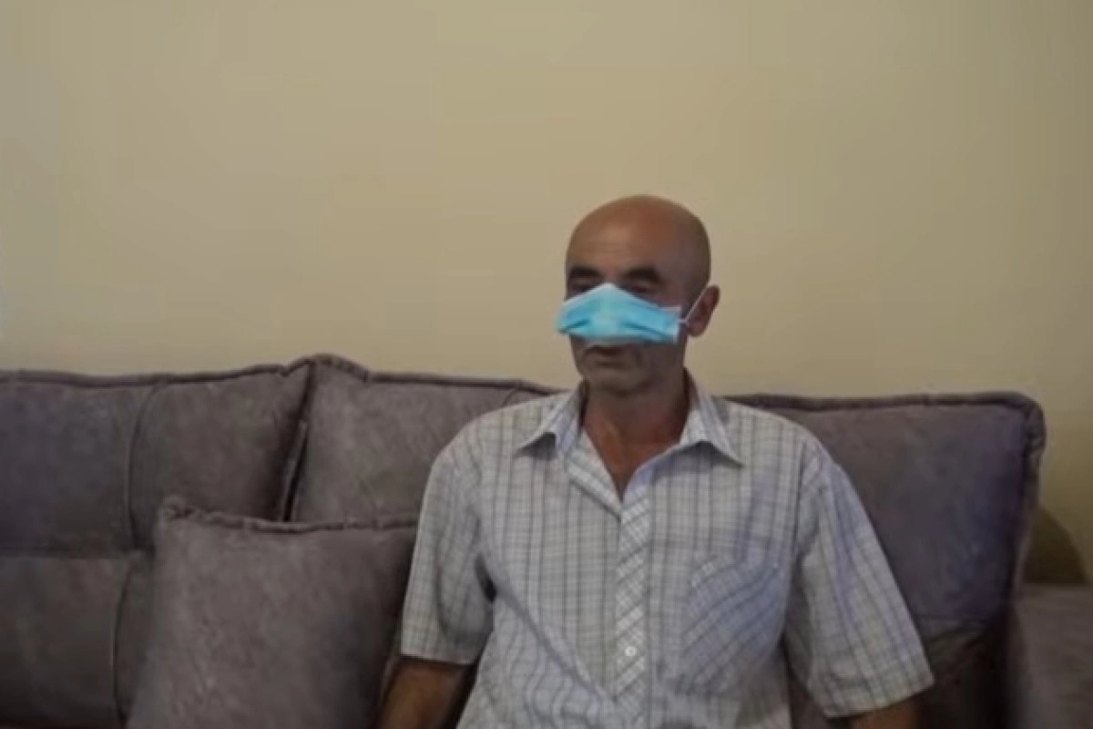 İt dişləməsi nəticəsində burnunu itirən pasiyent üzərində əməliyyat uğurla icra olunub