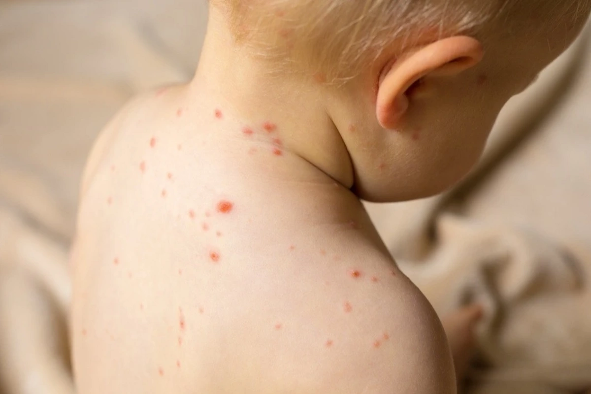 Su çiçəyi yenidən yayılır - XƏBƏRDARLIQ