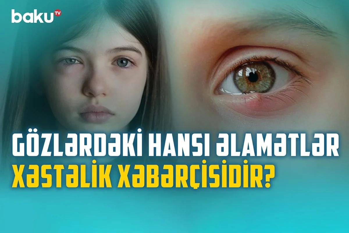 Как предотвратить ухудшение зрения?